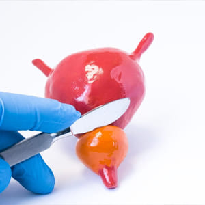 cirugia-de-prostata-por-crecimiento-prostatico